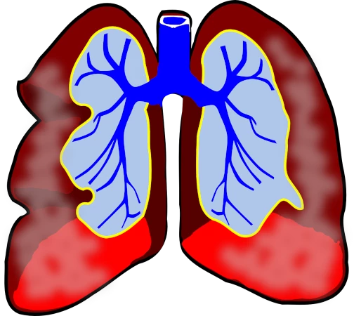 Precaution on Bronchitis